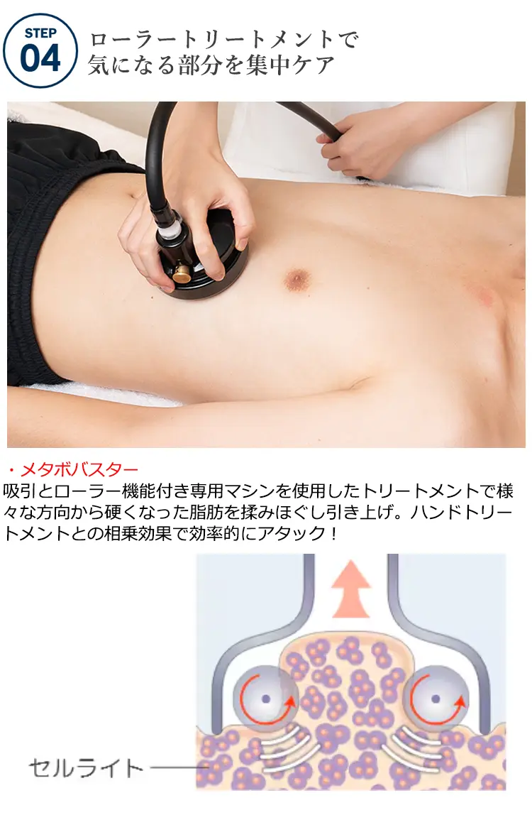 STEP04　ローラートリートメントで気になる部分を集中ケア ・メタボバスター吸引とローラー機能付き専用マシンを使用したトリートメントで様々な方向から硬くなった脂肪を揉みほぐし引き上げ。ハンドトリートメントとの相乗効果で効率的にアタック!