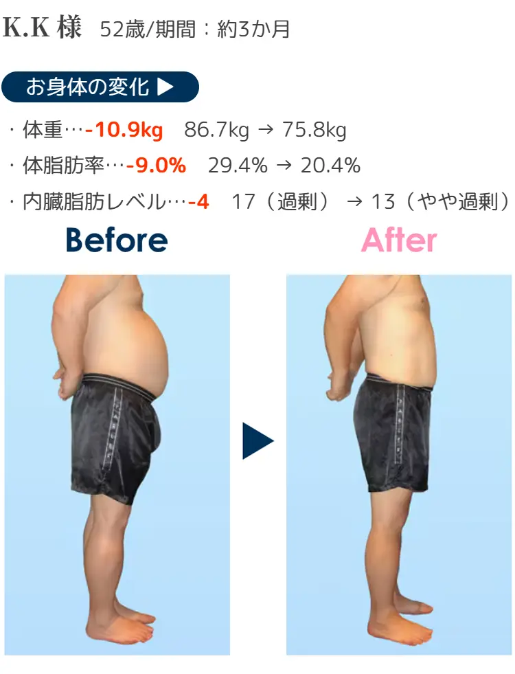 K.K様 52歳/期間:約3か月 お身体の変化 ·体重 …- 10.9kg 86.7kg→75.8kg ·体脂肪率 …- 9.0% 29.4%→20.4% ·内臓脂肪レベル …- 4 17(過剰)→13(やや過剰) Before After