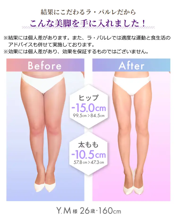 結果にこだわるラ·パルレだからこんな美脚を手に入れました! ※結果には個人差があります。また、ラ·パルレでは適度な運動と食生活のアドバイスも併せて実施しております。※効果には個人差があり、効果を保証するものではございません。BeforeAfter Y.M様
