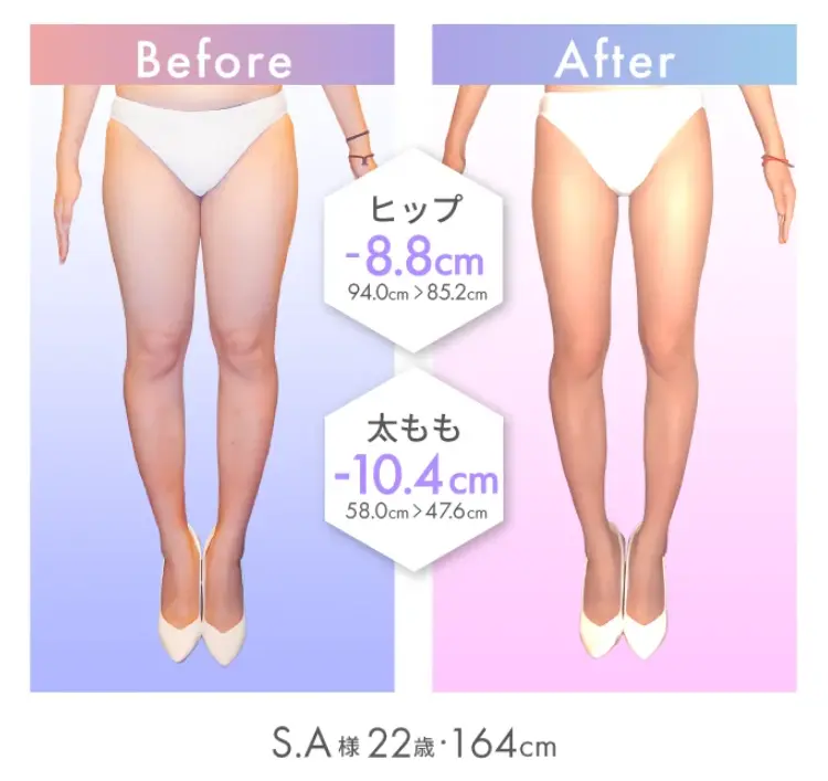 BeforeAfter S.A様