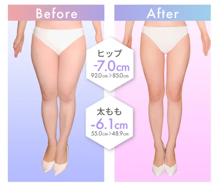 BeforeAfter
