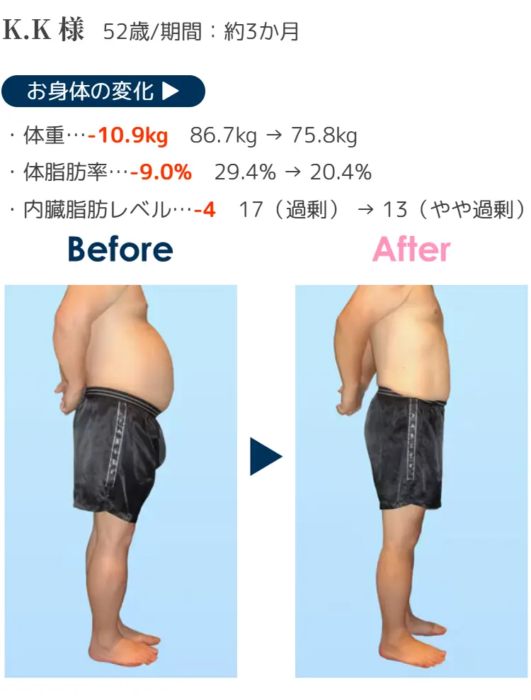 K.K様 お身体の変化·体重 …- 10.9kg 86.7kg→75.8kg·体脂肪率 …- 9.0% 29.4%→20.4%·内臓脂肪レベル …- 4 17(過剰)→13(やや過剰)52歳/期間:約3か月